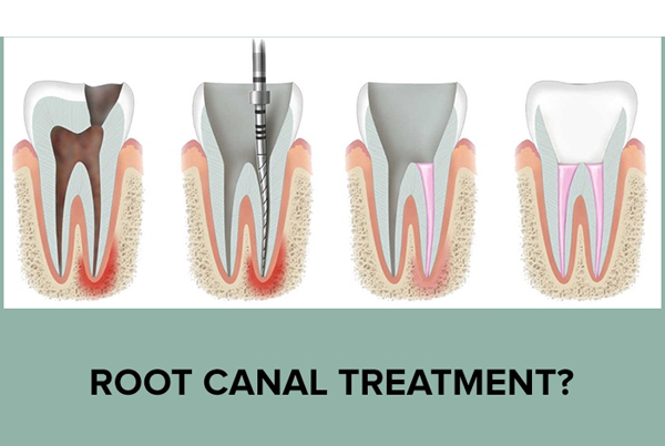 Leela Dental Clinic 